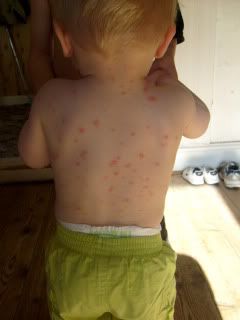 Sem met zijn waterpokjes